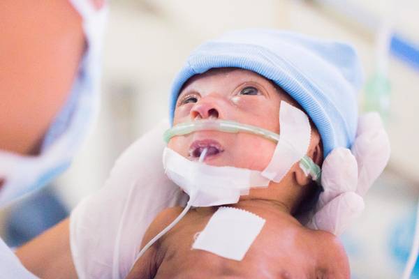 Premature baby in the intensive care unit for premature babies.