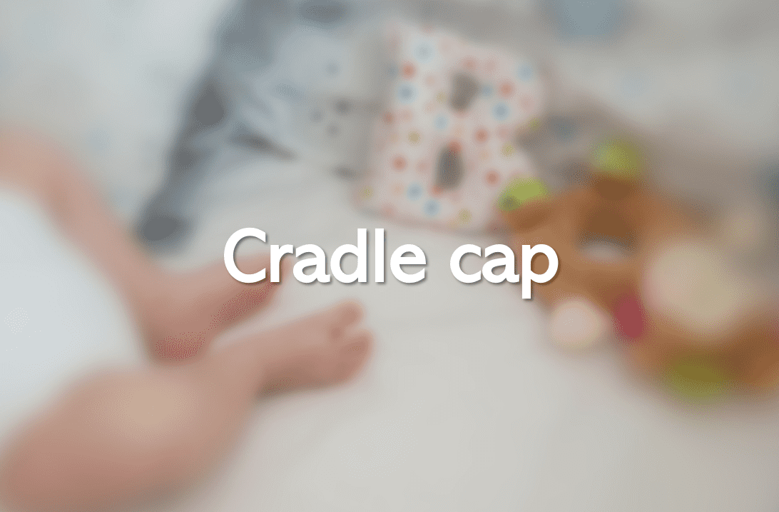 Cradle cap