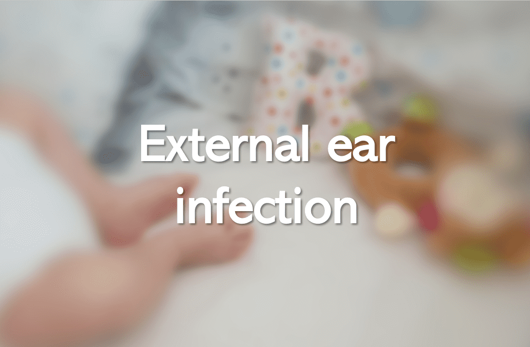 External ear infection