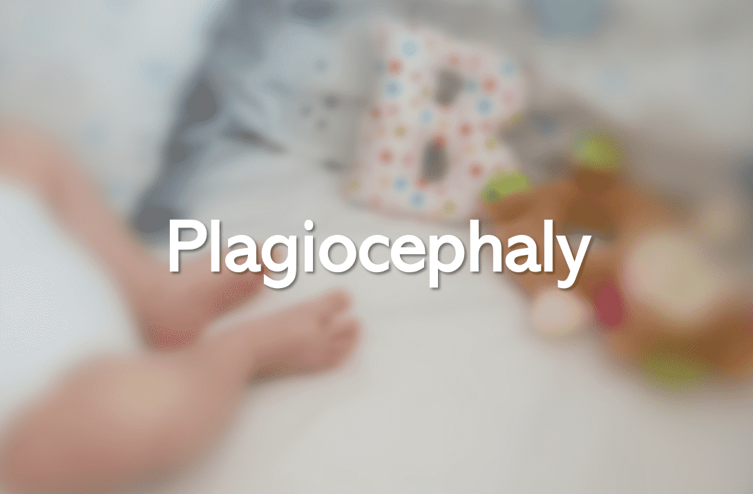 Plagiocephaly