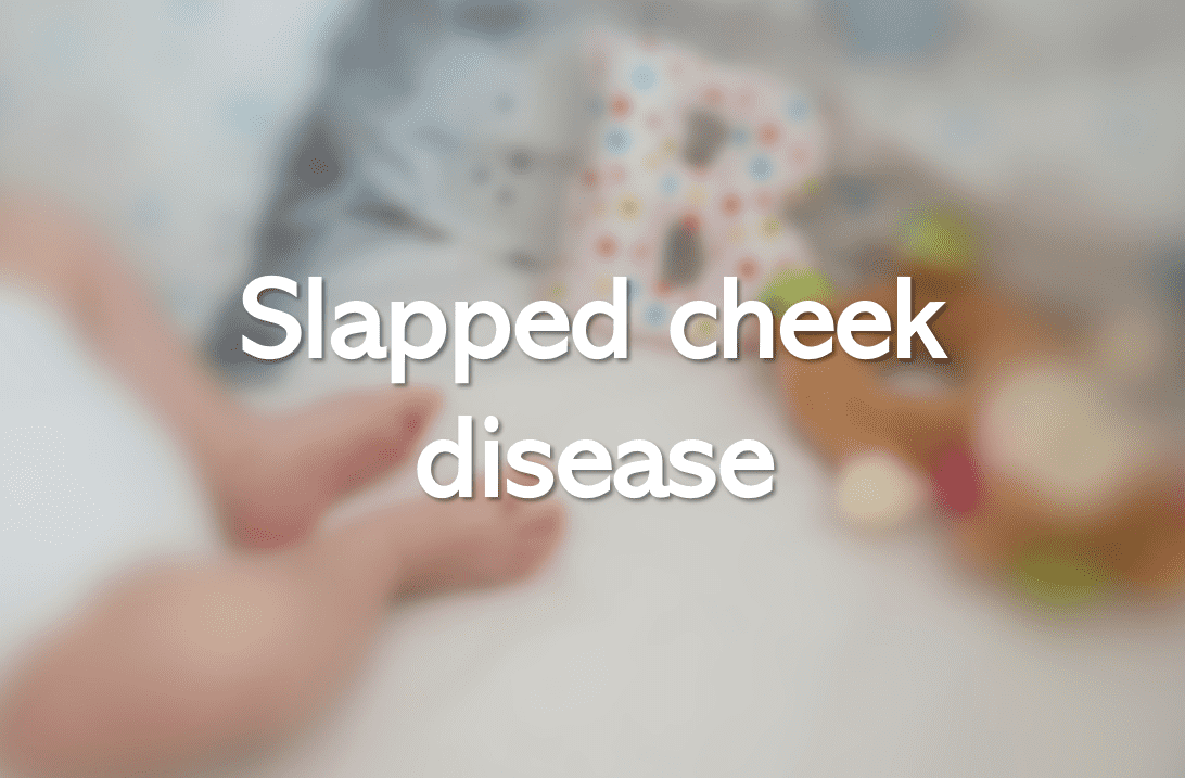 Slapped cheek disease
