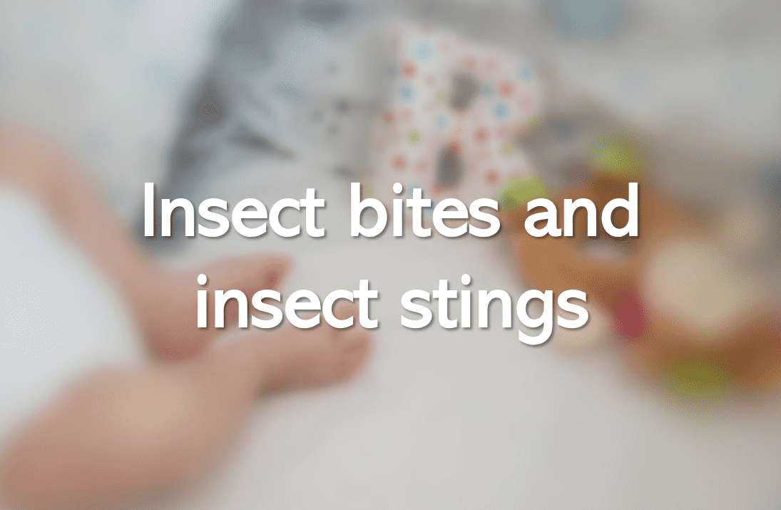 Insect bites and insect stings