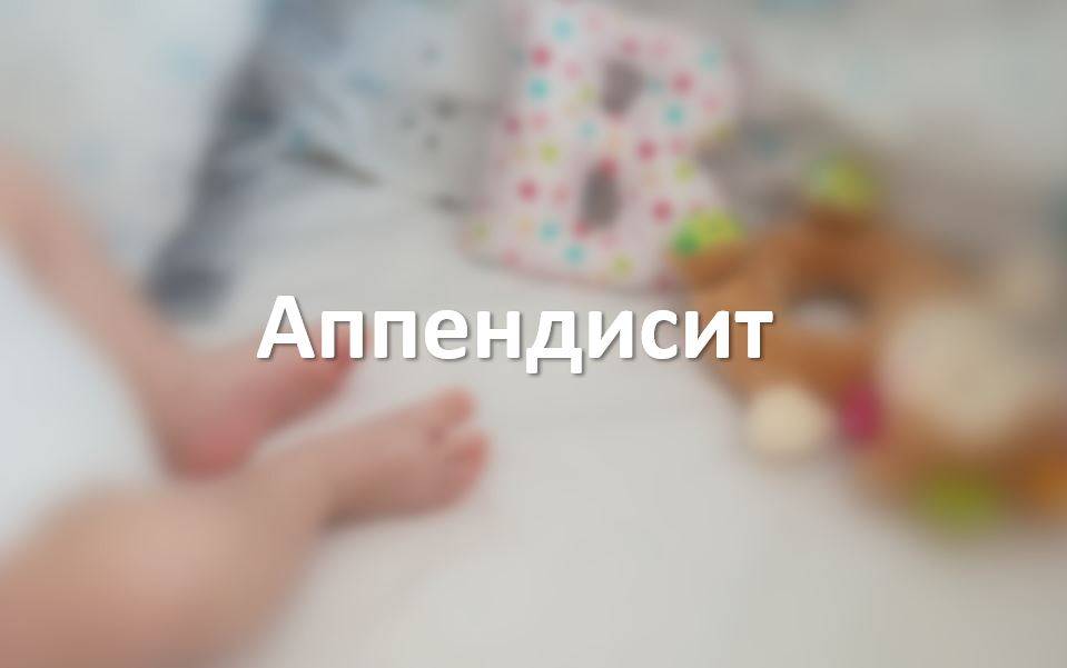 Аппендисит