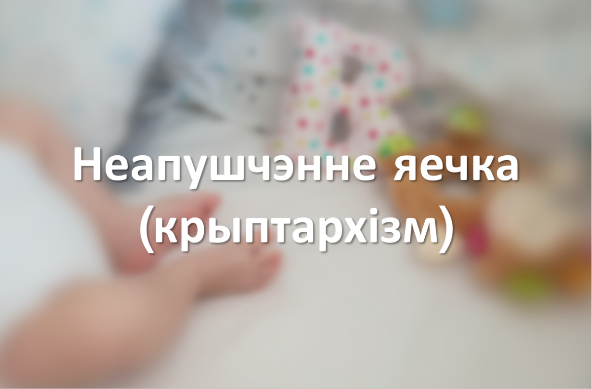 Неапушчэнне яечка (крыптархізм)