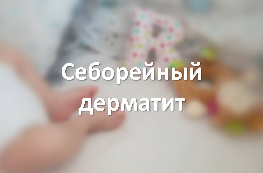 Себорейный дерматит