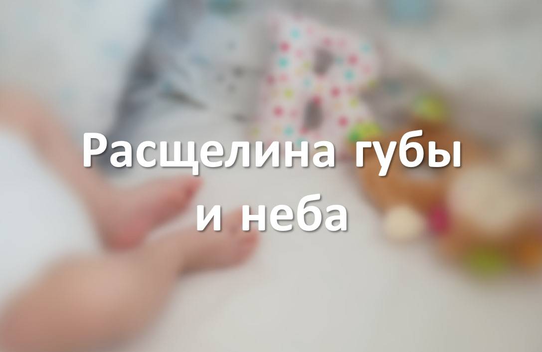 Расщелина губы и неба