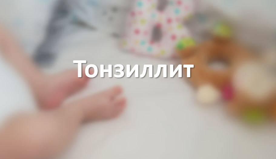 Тонзиллит