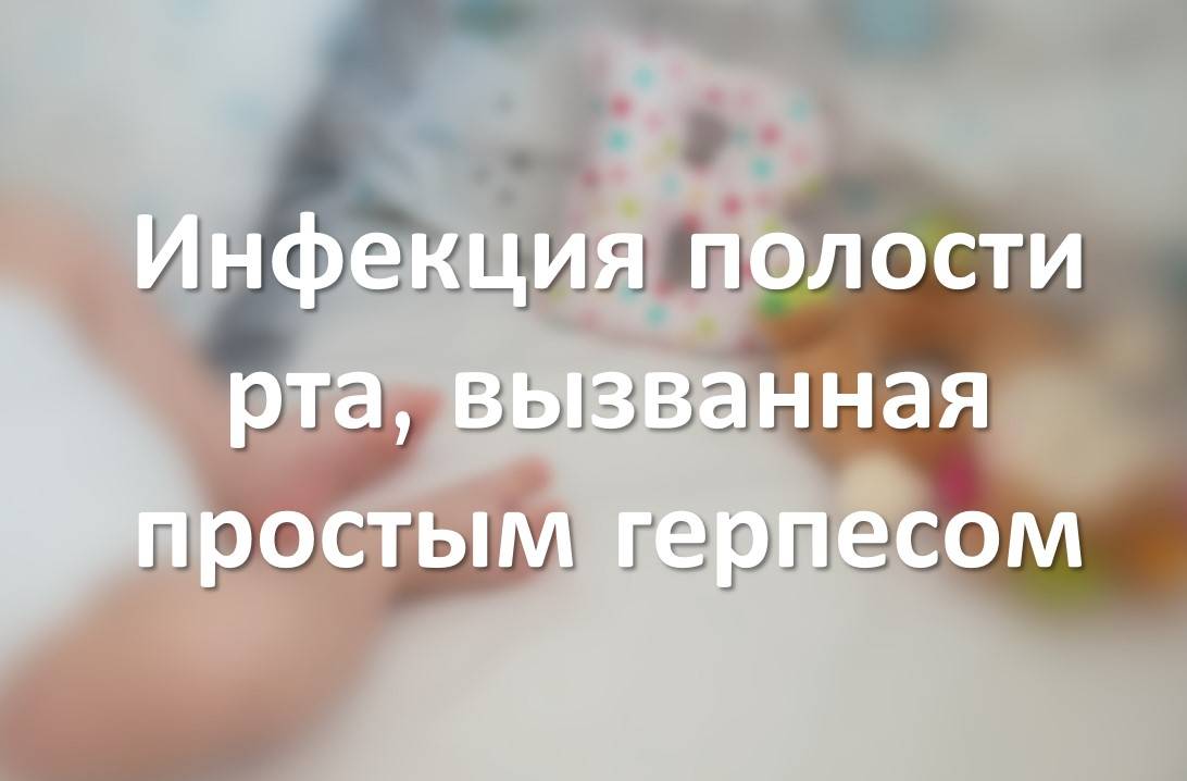 Инфекция полости рта, вызванная простым герпесом