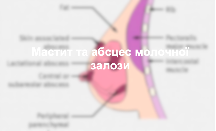Мастит та абсцес молочної залози