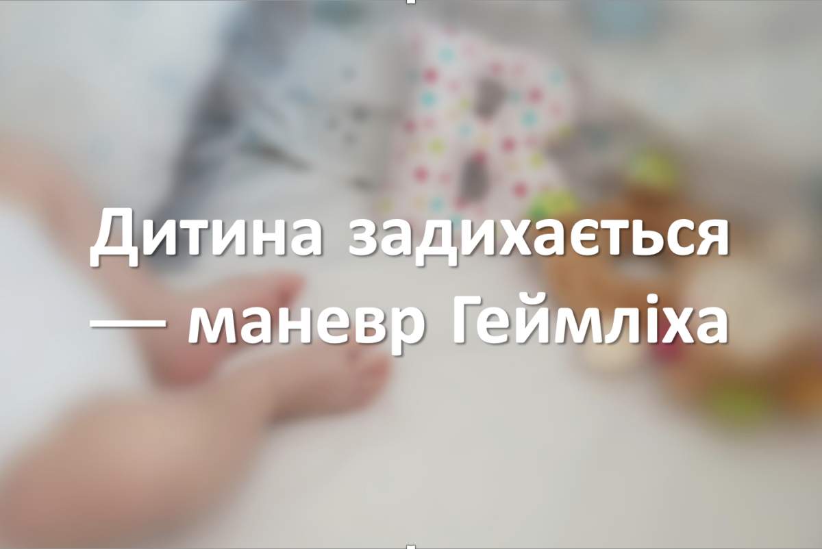 Дитина задихається — маневр Геймліха
