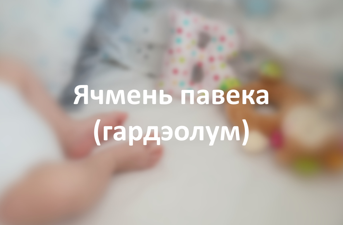 Ячмень павека (гардэолум)