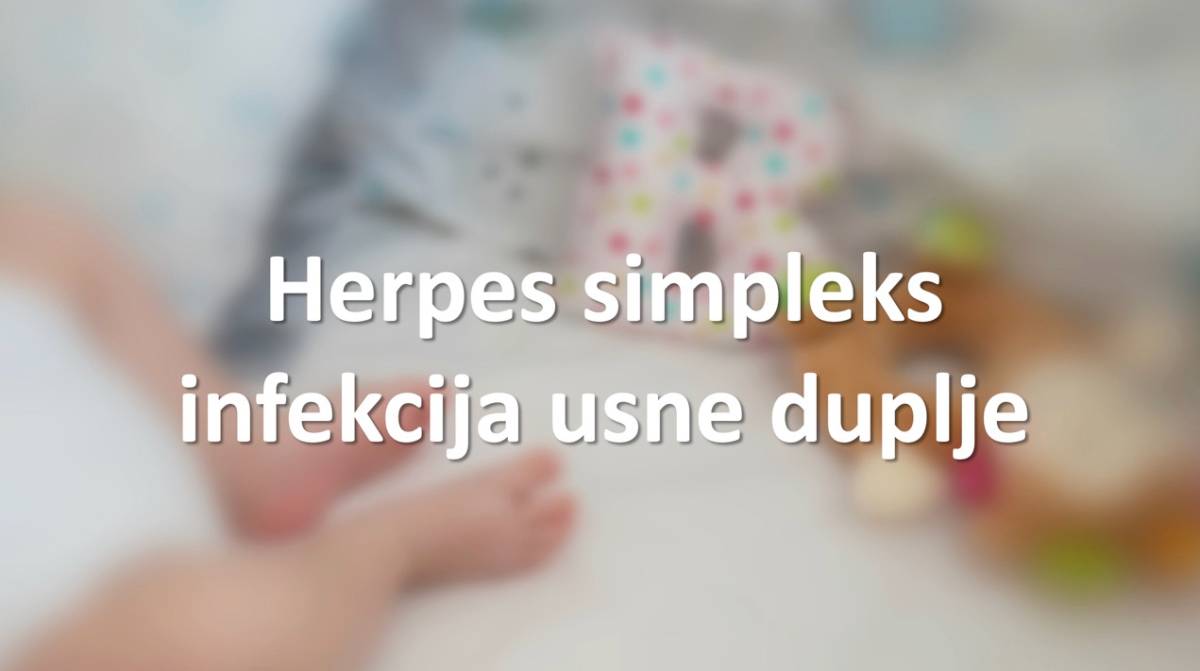Herpes simpleks infekcija usne duplje