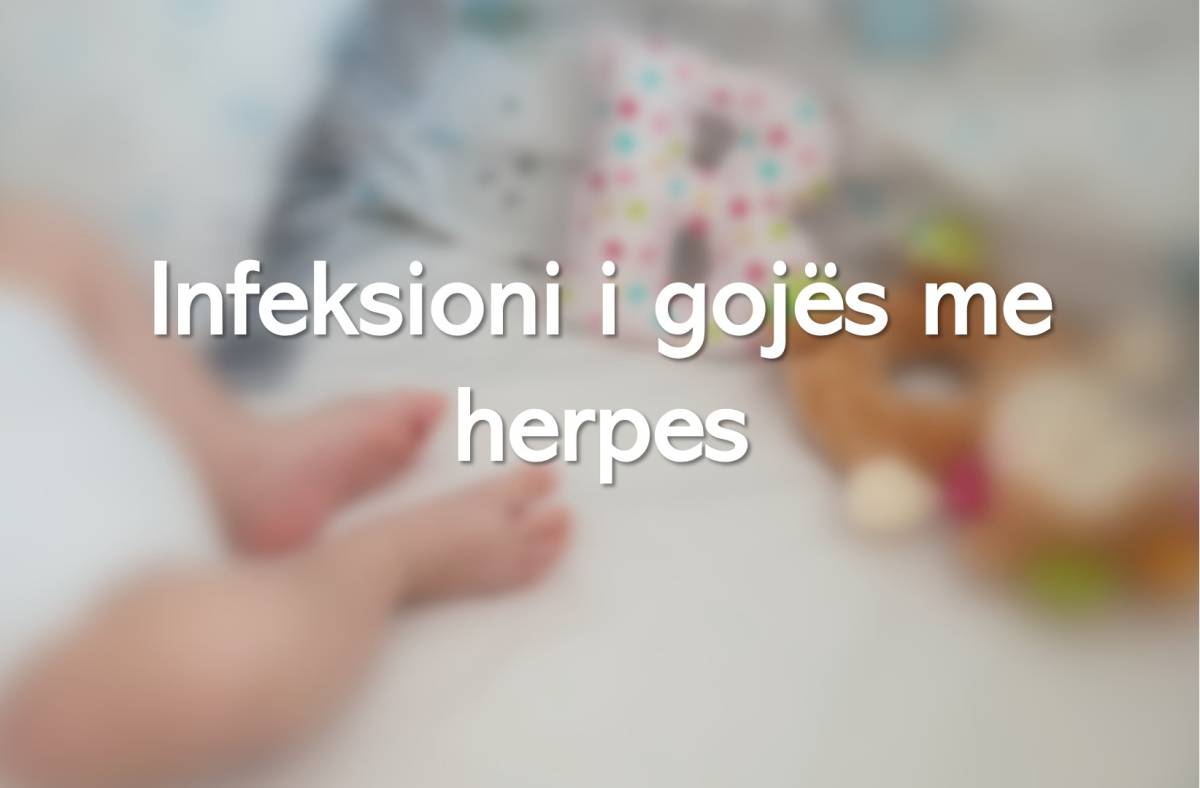 Infeksioni i gojës me herpes