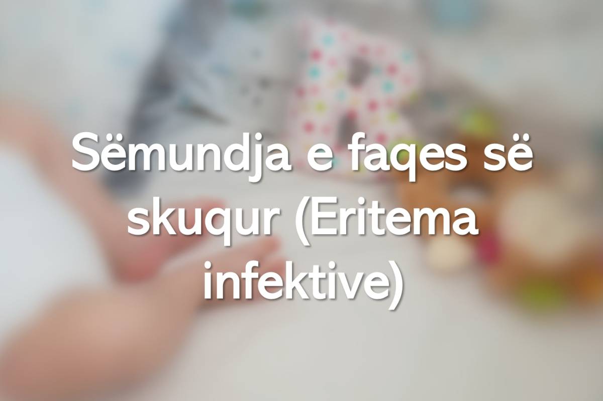 Sëmundja e faqes së skuqur (Eritema infektive)