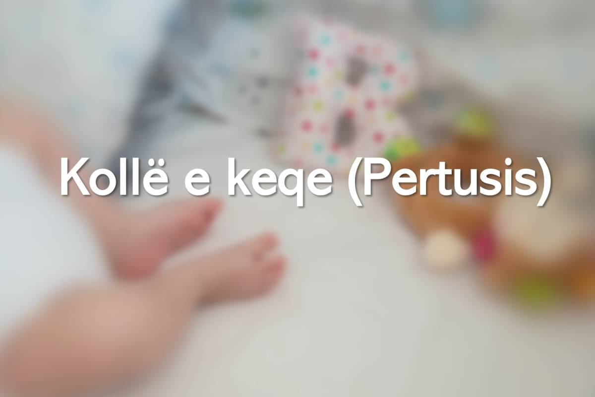 Kollë e keqe (Pertusis)