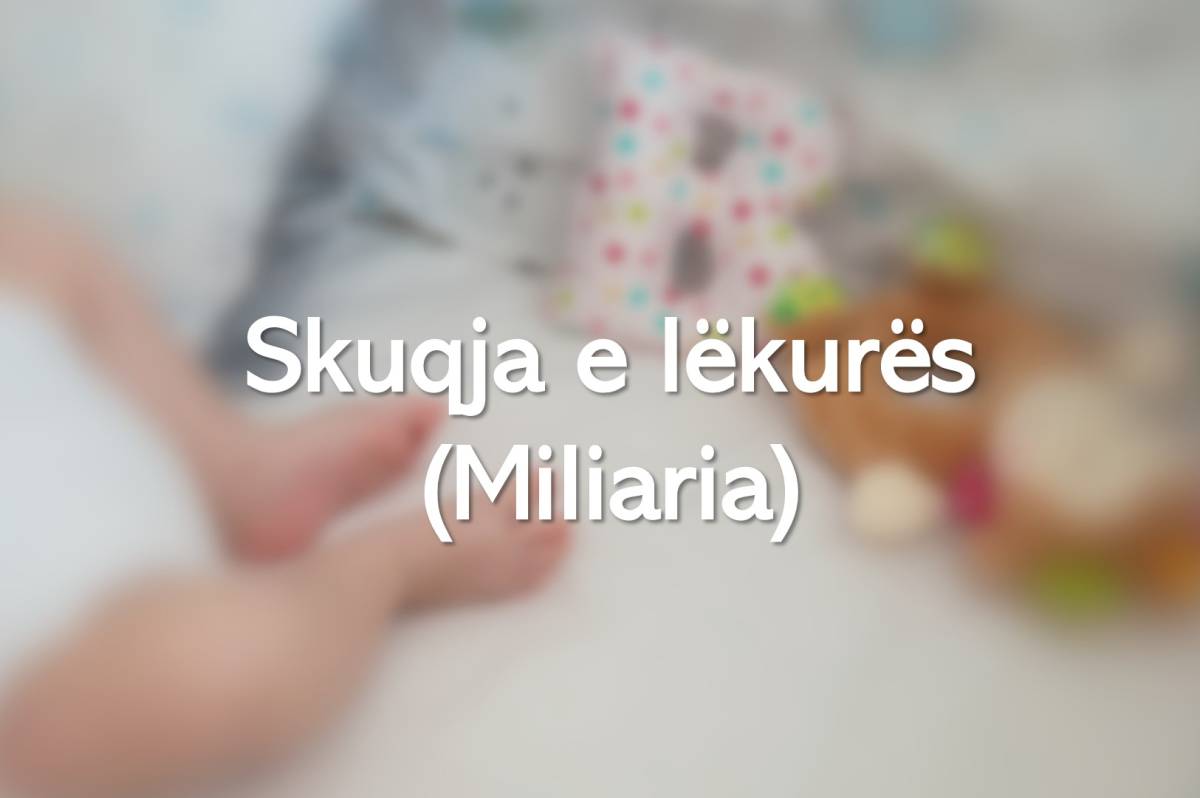 Skuqja e lëkurës (Miliaria)