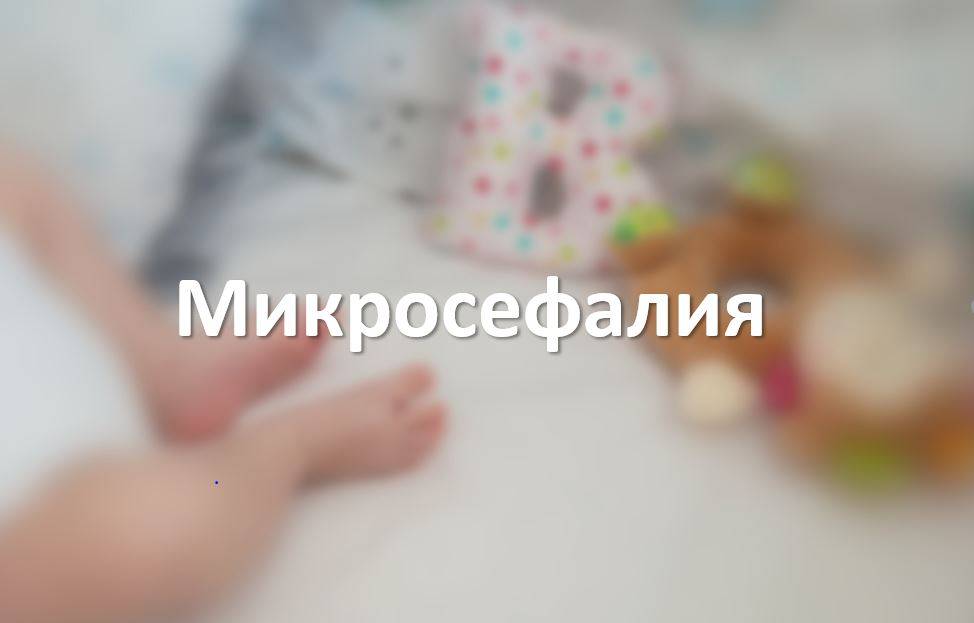 Микросефалия
