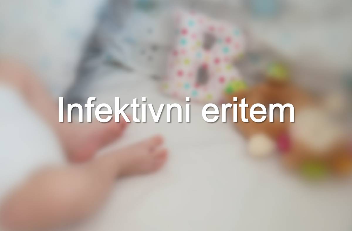 inf. eritem