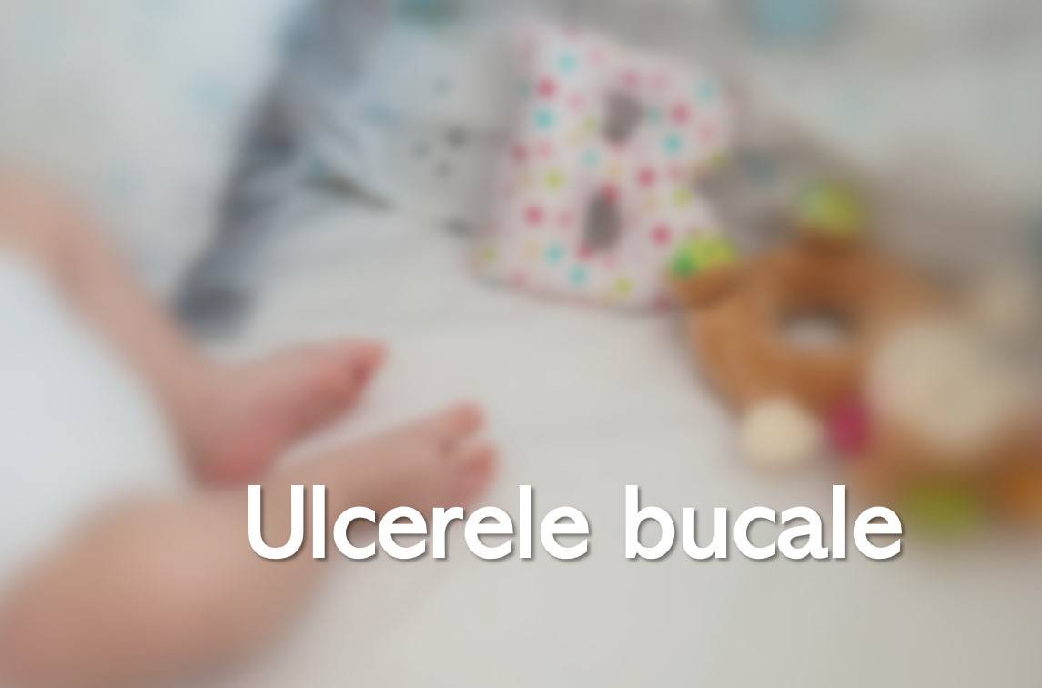Ulcerele bucale