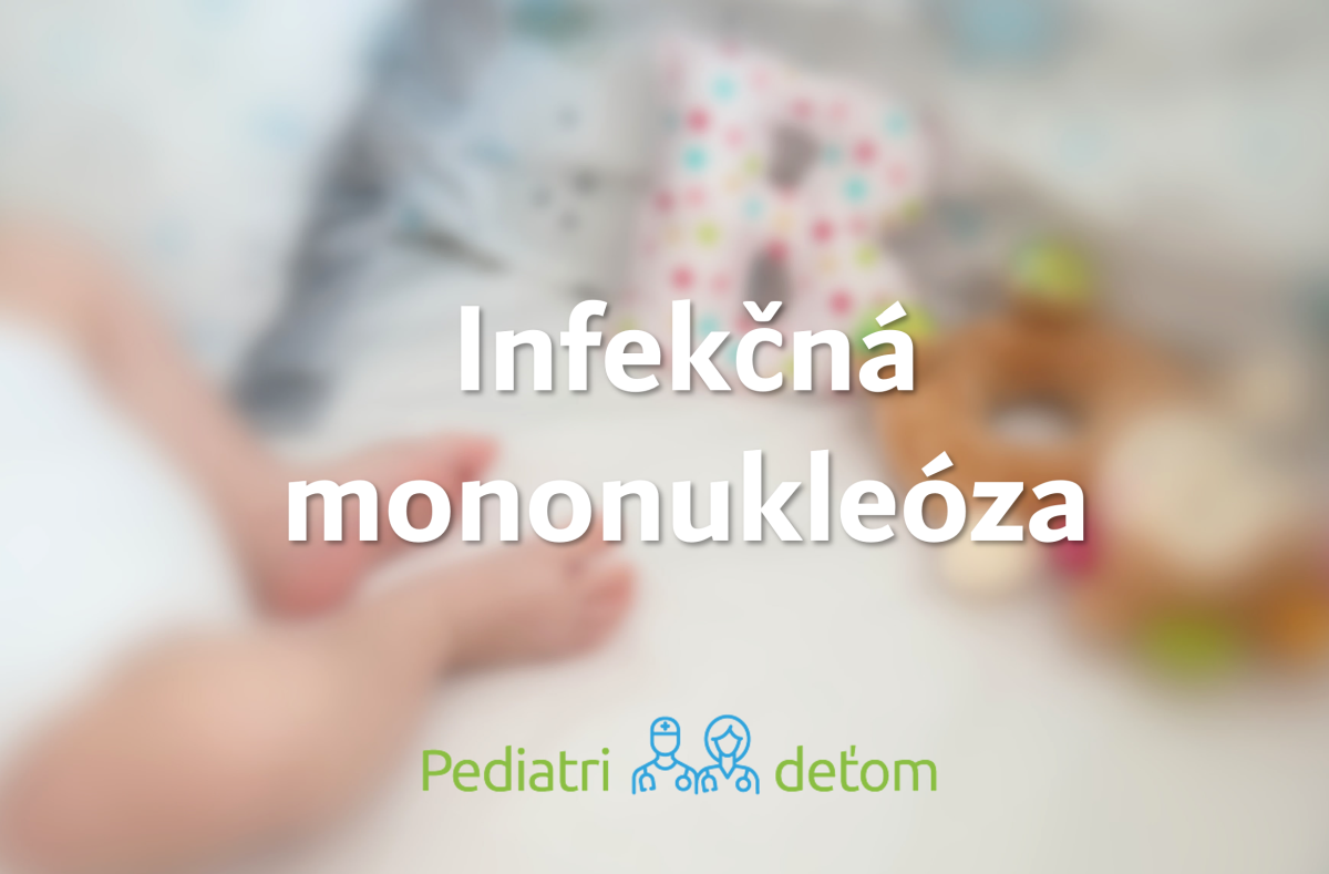Mononukleóza