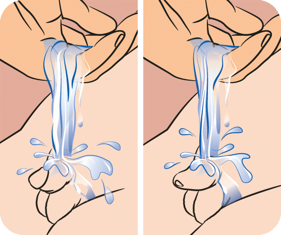 hygiena genitálií