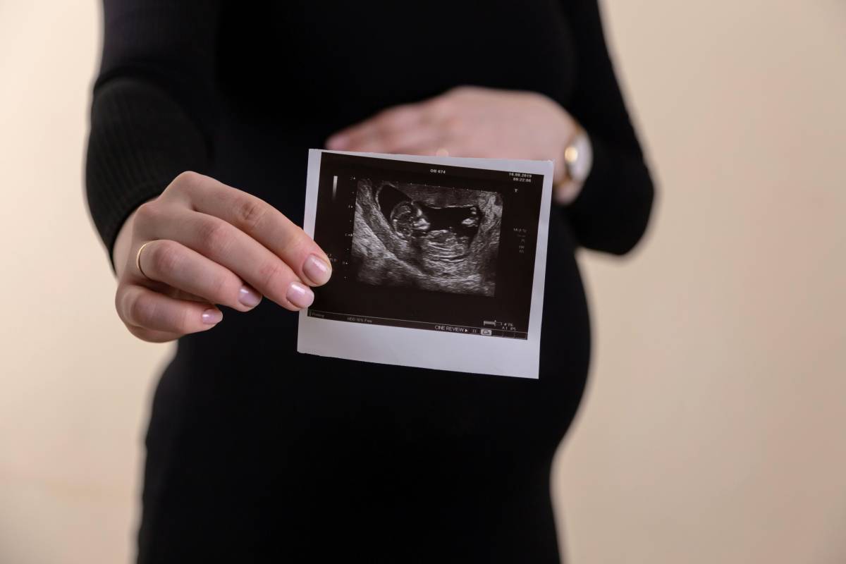 Child with chromosomal abnormality