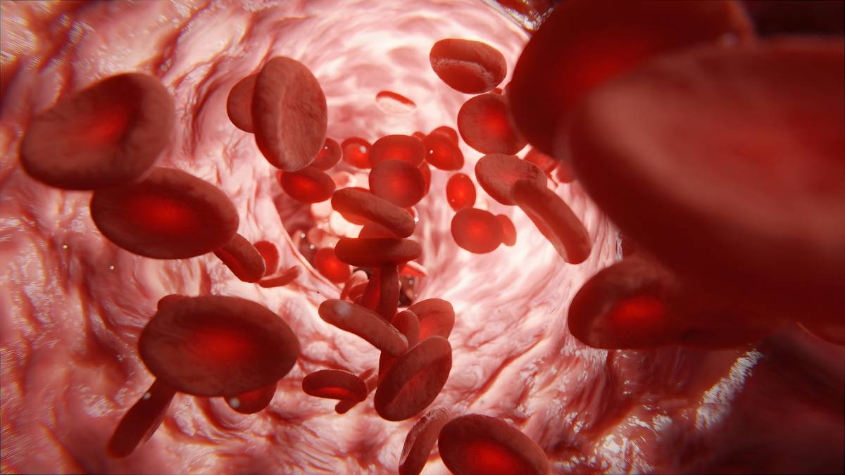 Anaemia