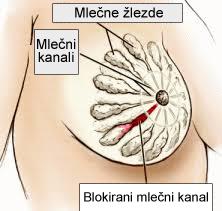 Blokirani mlečni kanali