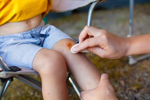 First aid: bleeding from an injured child's knee
