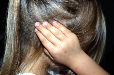 A girl covering her head with the hands covered with bruises 