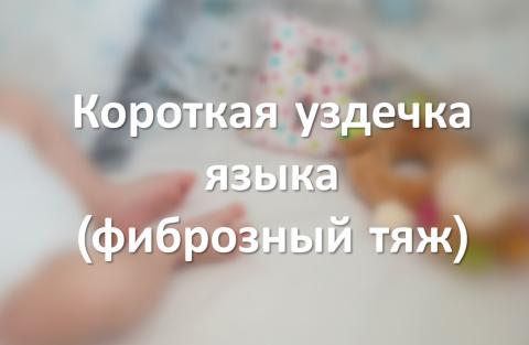 Короткая уздечка языка (фиброзный тяж)