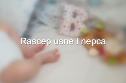 rascep usne