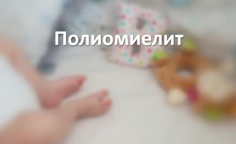 Полиомиелит