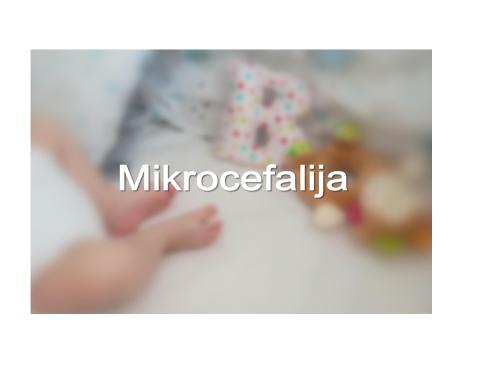 mikrocefalija
