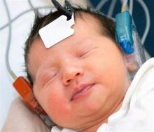 Newborn hearing test