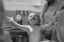 Caesarean birth